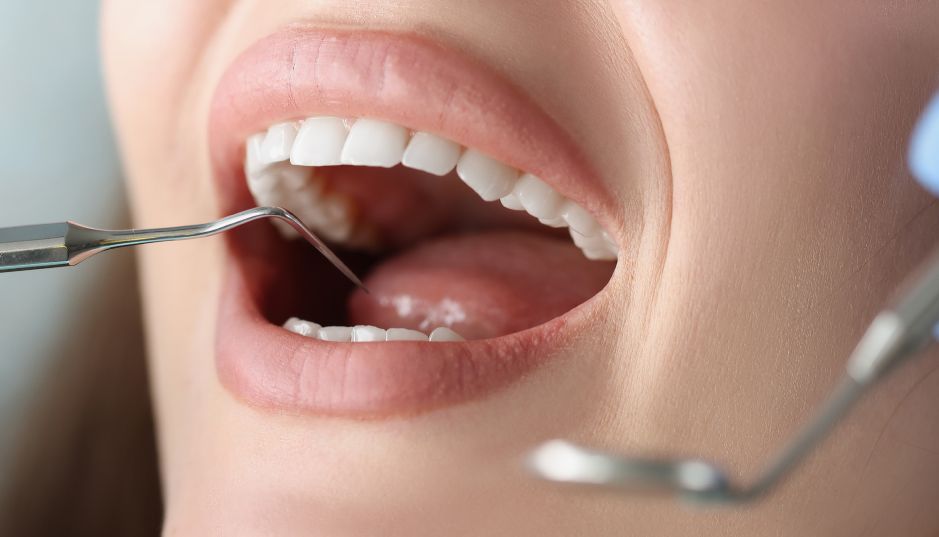 Apenas 3 de cada 10 españoles cuenta con un seguro dental